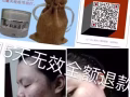 祛痘膏，专治痘痘，痘印，美白，控油，承诺十五天无效全额退款