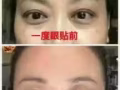 1度眼贴（ 呵护眼睛，1度眼贴，缓解眼疲劳干涩痛，黑眼圈，眼袋，降低近视，结膜炎