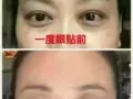 1度眼贴（ 呵护眼睛，1度眼贴，缓解眼疲劳干涩痛，黑眼圈，眼袋，降低近视，结膜炎