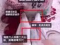 鑫玺足贴