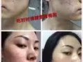 伊能静代言的时时清酵素青梅