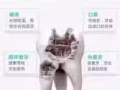 碧緹福美牙儀－－最便攜且安全有效的美白牙齒儀器