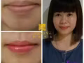 修复受损唇部干燥脱皮,唇白，唇乌