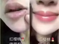 修复受损严重的嘴唇