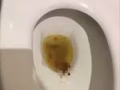无效退款