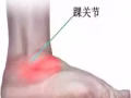 關節炎、頸椎病、耳療、足部矯正、脊椎矯正， 免開刀免吃藥疼痛奌緩解