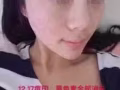英树护肤品让你拾回自信(无任何改善全额退款）