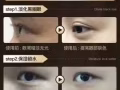 美思可眼贴-eyes mask