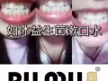 如沐益生菌漱口水