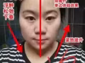 改善痘痘肌，敏感肌，痘印，改善皺紋，美白淡斑！
