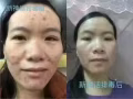新神话脸部排毒抗衰液