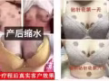 贴针灸丰胸，我手上有有9盒全部只要$200