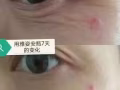 破尿酸-我的最爱?