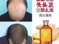 优源三棵姜防脱生发洗发水