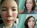 纯中草药药疗，首次体验38