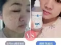 玻尿酸是每个人体内都需要的一种成分   畅销国内外