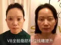 韩式微整大优惠哦