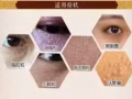 除痣不留疤