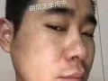 排毒祛痘