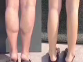 微整容