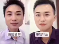 微整容