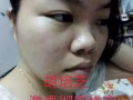 祛痘去印霜