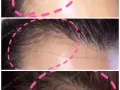 睫毛增长液?牛逼产品！女士的睫毛守护着可以快速的增长睫毛