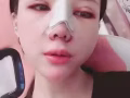网红鼻的时尚元素/台湾隆鼻