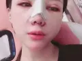 网红鼻的时尚元素/台湾隆鼻