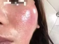 小心这女的卖药吃的脸肿成那样