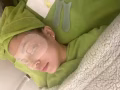 眼睛刮痧