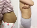 产后护理按摩