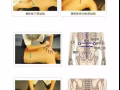 原始点推拿治病兼养生，可治，偏头痛 颈椎病 胃痛 腰疼 腰间盘突出 妇科