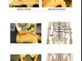 原始点推拿治病兼养生，可治，偏头痛 颈椎病 胃痛 腰疼 腰间盘突出 妇科