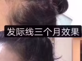 安全有效生发
