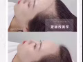 安全有效生发