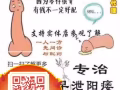 男士保健大全
