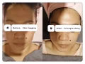 Natural Oxygen Facial Treatment