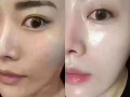 优惠多多活动多多。微调让你更美丽 ！！微整来找我