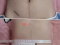 减肥瘦身