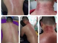 经穴拨筋经治疗师