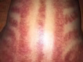 Starry Traditional Massage