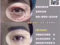 🏥 81萾YlNG国际贸易 💉医疗美容抗衰减肥 ☎️，91506518