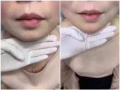 腋下永久脱毛一年$1xx！洗脸$38起。提供瘦脸针等医美服务。