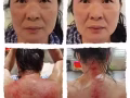 新加坡第一品牌｛爱眼净眼健康调理｝