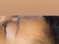 韩式半永久纹发际线 男女都可以做
