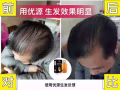 防脱生发、控油去屑