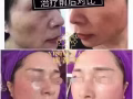 专业祛斑