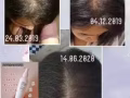 脱发救星⭐️生毛丹养发液