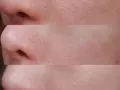 韩国面膜